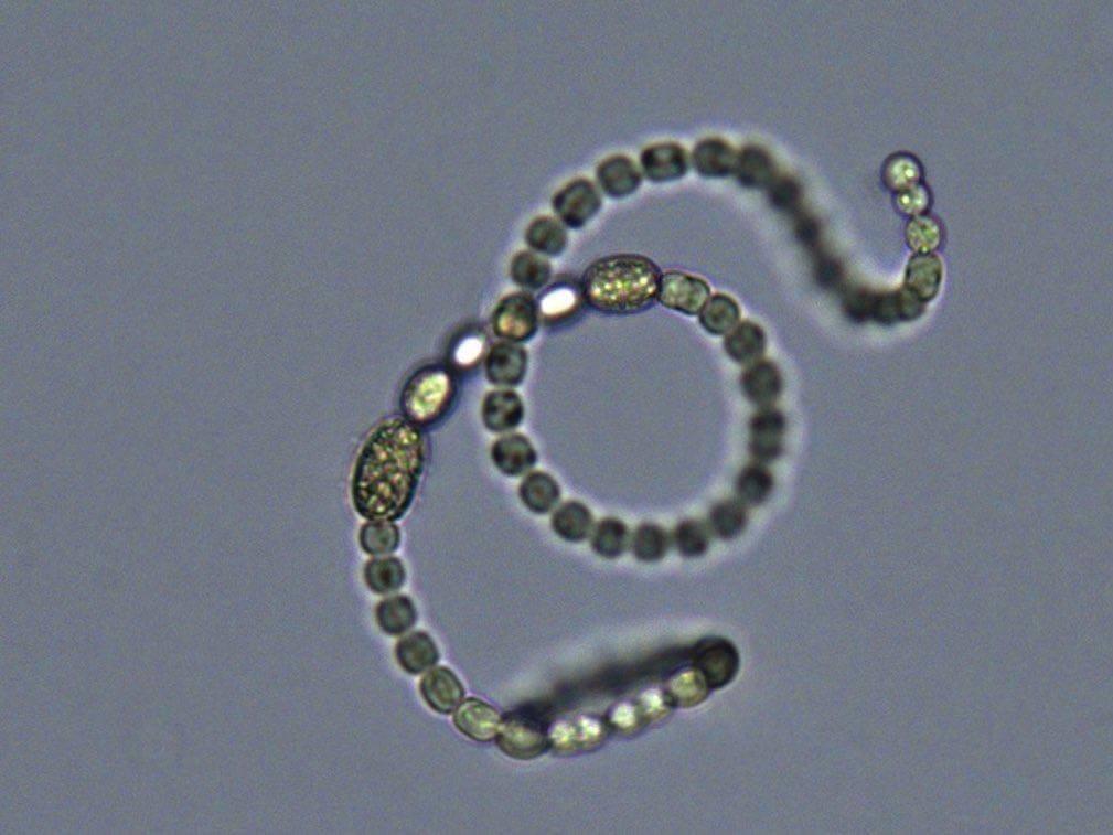 Microscope image of cyanobacteria